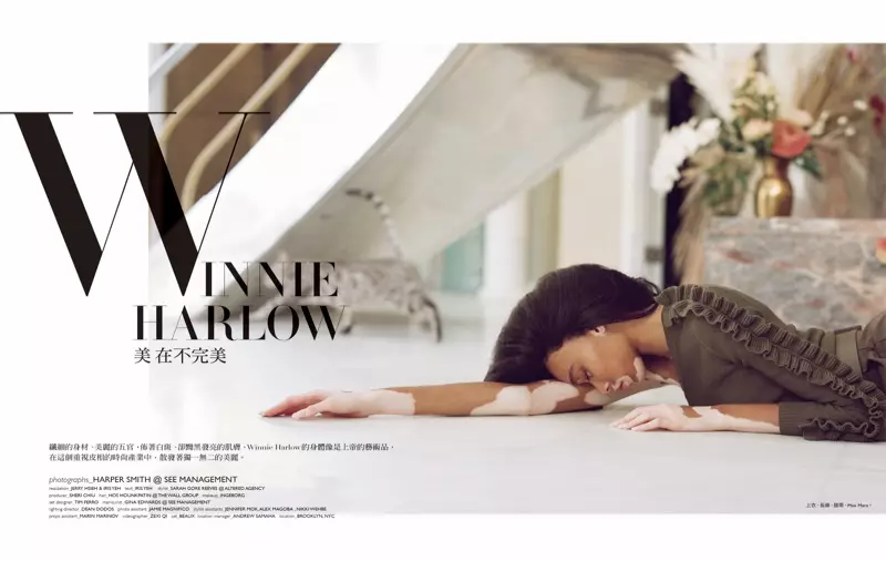 Winnie Harlow Memakai Animal Prints di Harper's Bazaar Taiwan