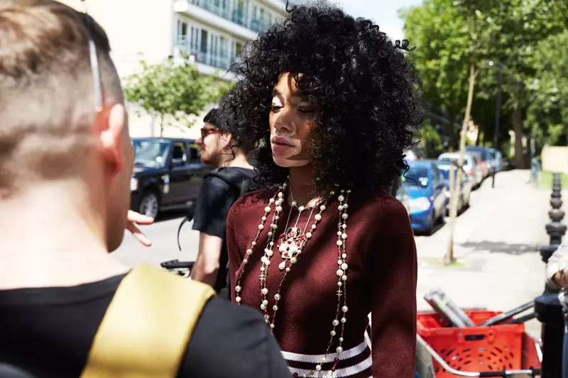 Winnie Harlow, model z vitiligom, služi kot navdih za tiste s kožno boleznijo