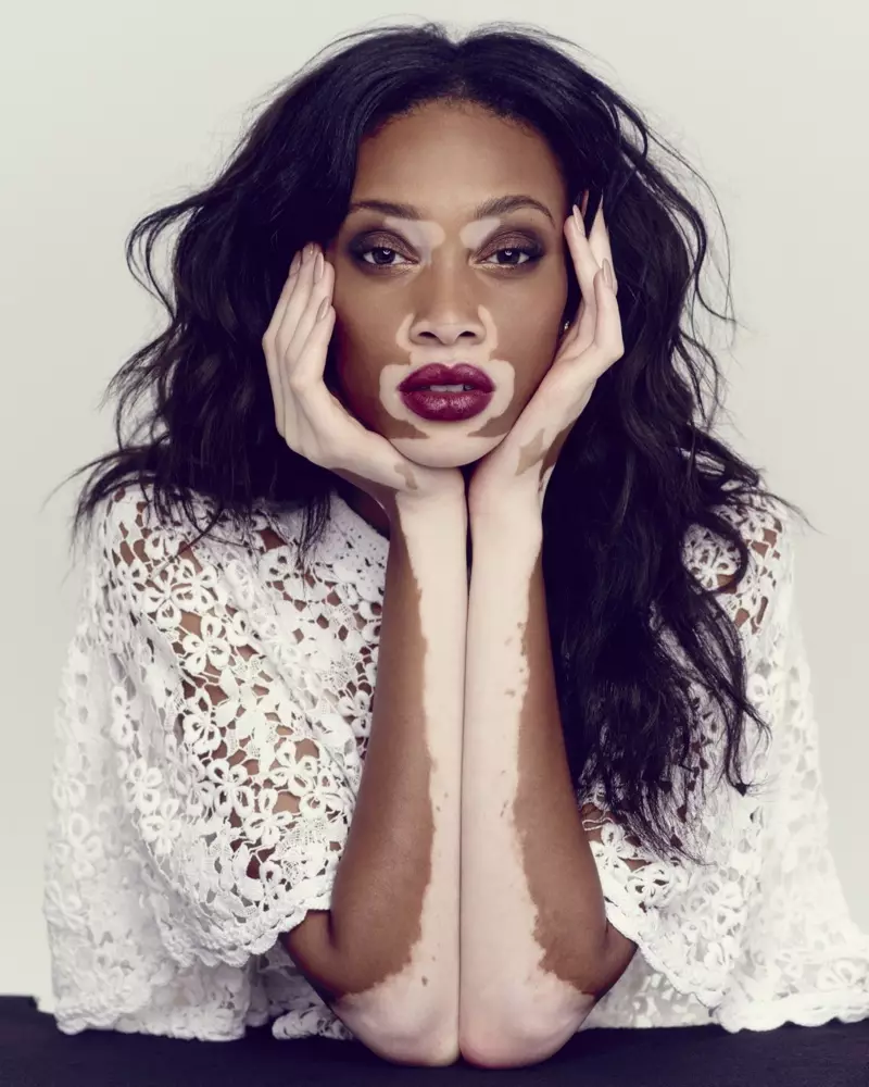 Winnie Harlow kintana amin'ny sary ho an'ny The Observer. Sary: Mary Rozzi