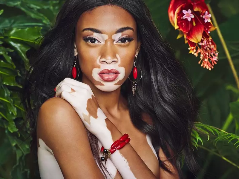 Winnie Harlow poserar för Desiguals vår-sommar 2015 Flower Capsule-reklamkampanj.