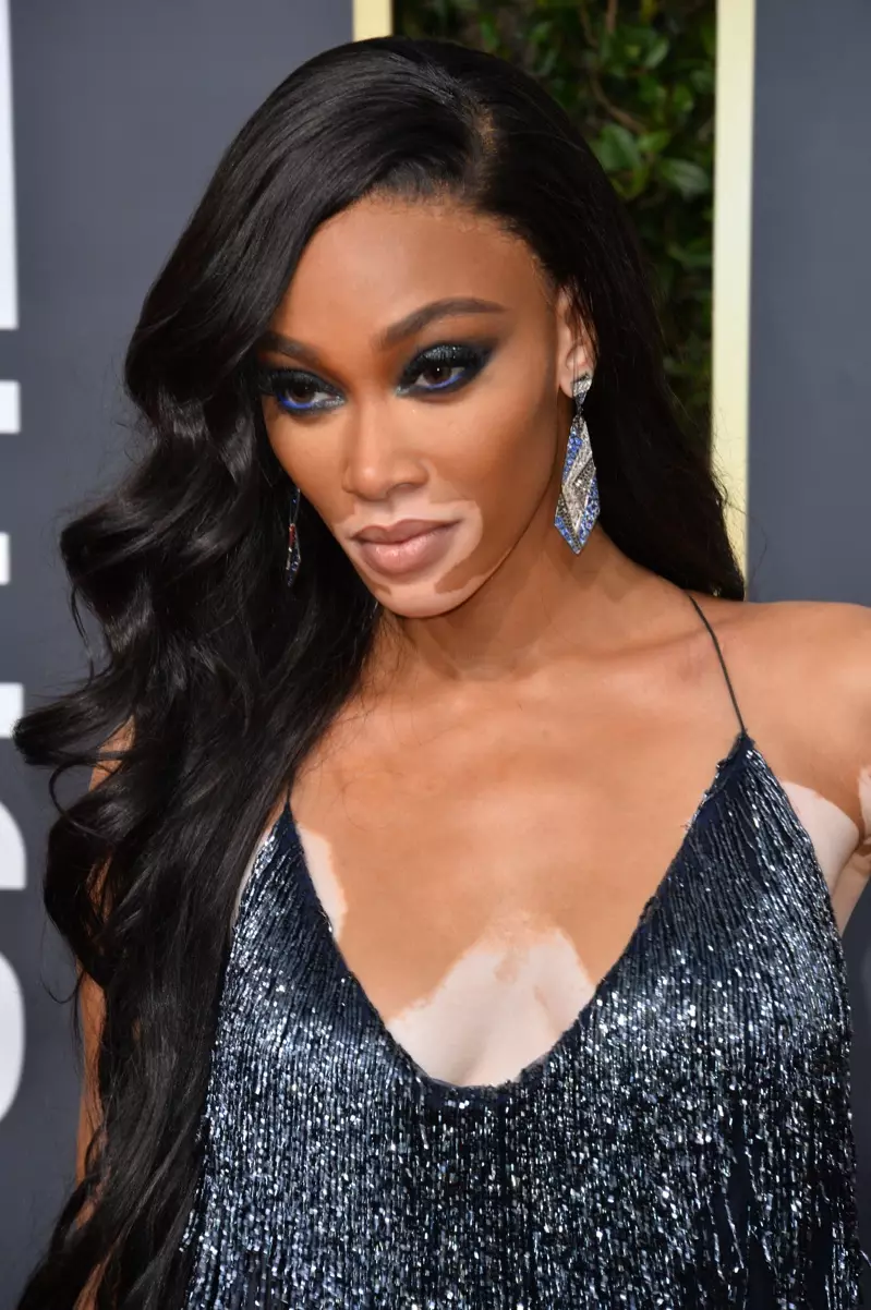 Winnie Harlow modell