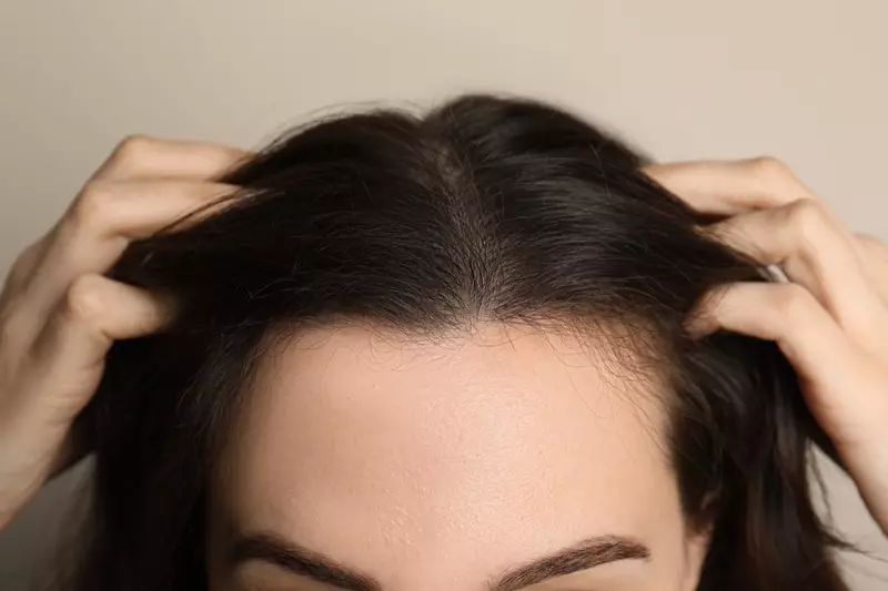 Nærbillede kvindes hovedbund skaldet tyndere hår