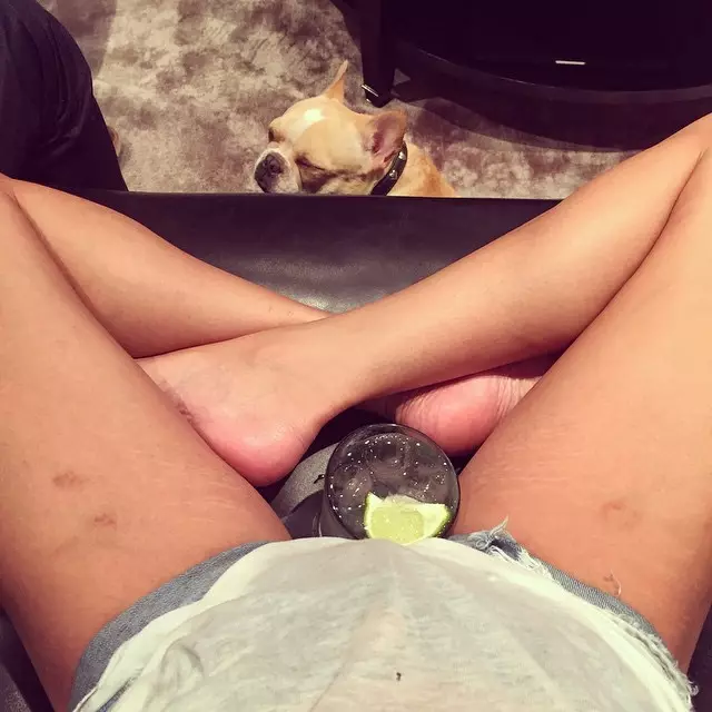 ในเดือนเมษายน Chrissy Teigen โพสต์ภาพรอยแตกลายและรอยฟกช้ำบน Instagram พร้อมคำบรรยายใต้ภาพ: